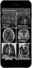 Radiology CT And MRI Anatomy screenshot 12