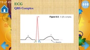 Basic ECG Interpretation screenshot 2