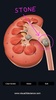 Urinary System screenshot 12