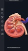 Urinary System screenshot 16