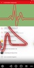 ECG / EKG Rhythm Step-by-Step Interpretation screenshot 6