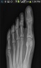 X-Ray Scanner screenshot 2