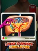 Liver Surgery screenshot 6