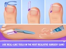 Nail Surgery Foot Doctor - Offline Surgeon Games screenshot 4