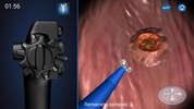 Endoscopy 3D (Free) screenshot 10
