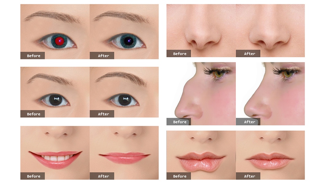 PhotoPlasticSurgeryProfessional - Preview 3