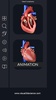 Heart Anatomy Pro. screenshot 8
