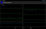 Bedside ECG Monitor screenshot 6