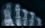 Xray Prank screenshot 2