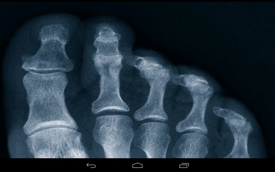 Xray Prank - Preview 2