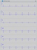 Istel ECG screenshot 2