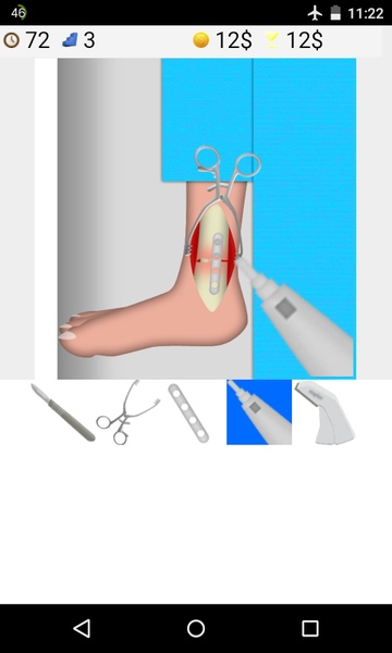 Ankle Surgery - Preview 5
