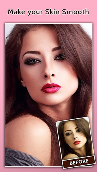 Face Blemish Remover - Preview 5