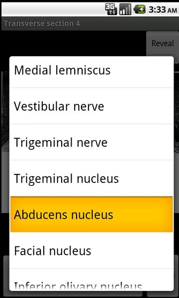NeuroSlice - Preview 3