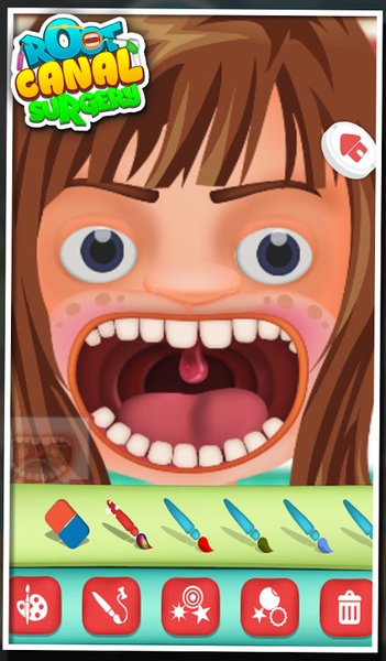 Root Canal Surgery - Preview 2