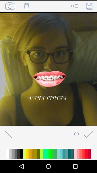 Braces - Preview 1
