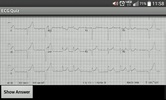 ECG_Quiz screenshot 2