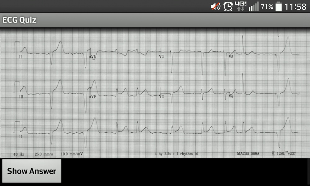ECG_Quiz - Preview 2