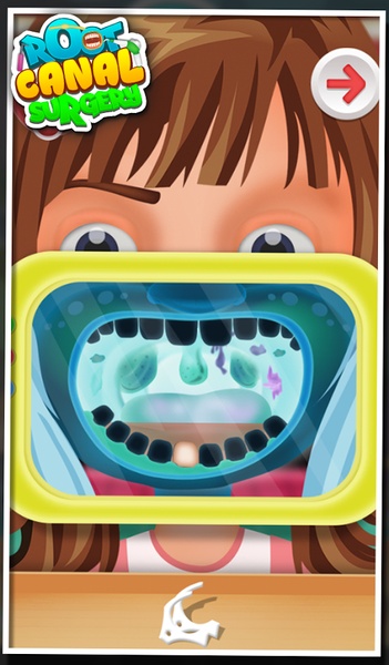 Root Canal Surgery - Preview 4