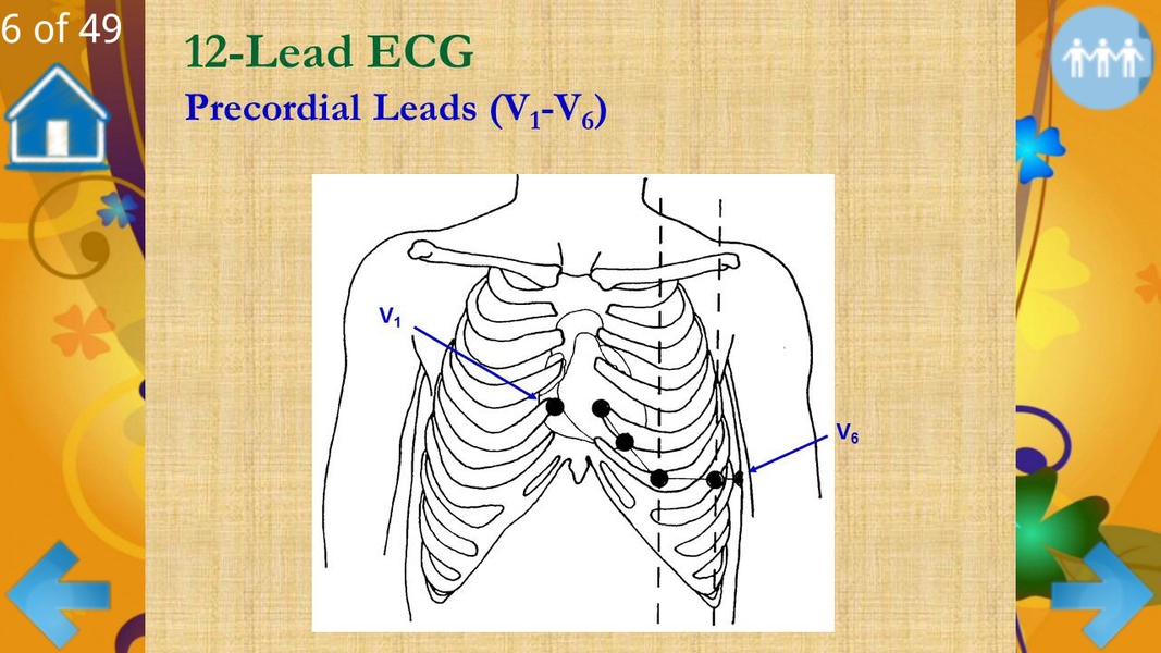 Basic ECG Interpretation - Preview 6