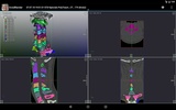DroidRender - 3D DICOM viewer screenshot 3
