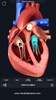 Heart Anatomy Pro. screenshot 11