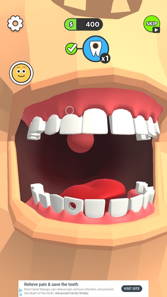 Dentist Bling - Preview 2