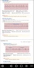 ECG / EKG Rhythm Step-by-Step Interpretation screenshot 3