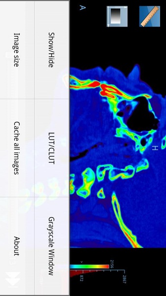 Droid Dicom Viewer - Preview 1