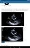 Basic - Transthoracic Echocardiography screenshot 5