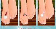 pedicure after injury screenshot 7