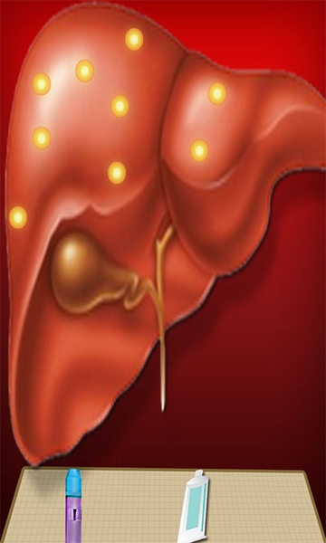 LiverSurgerySimulator - Preview 1
