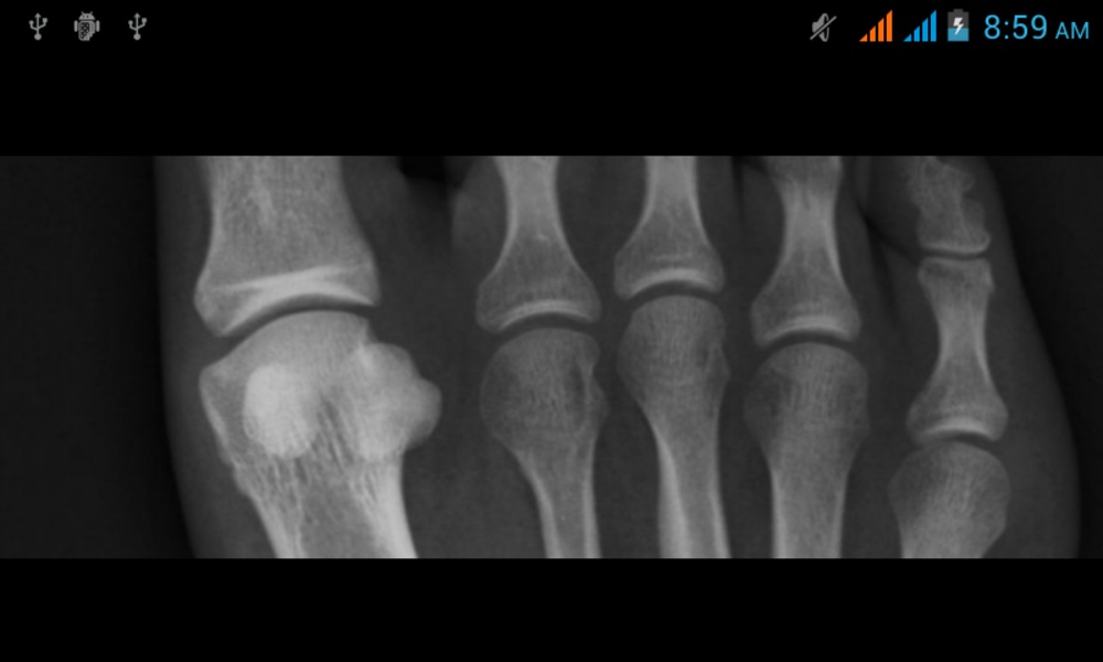 XRay - Preview 3