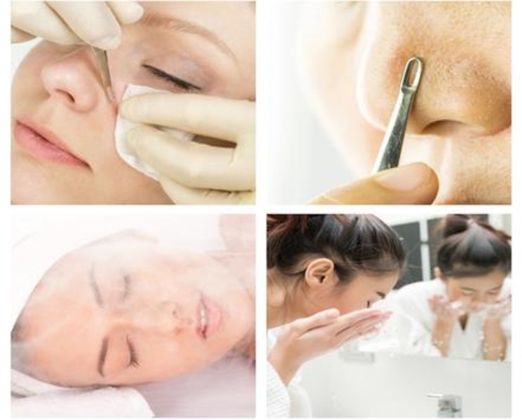 Blackheads Removal - Preview 1