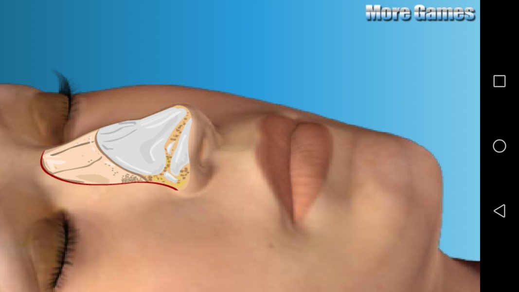 Nose Doctor - Preview 4