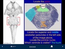 Neuroanatomy - SecondLook screenshot 1