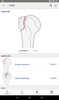 AO/OTA Fracture Classification screenshot 7