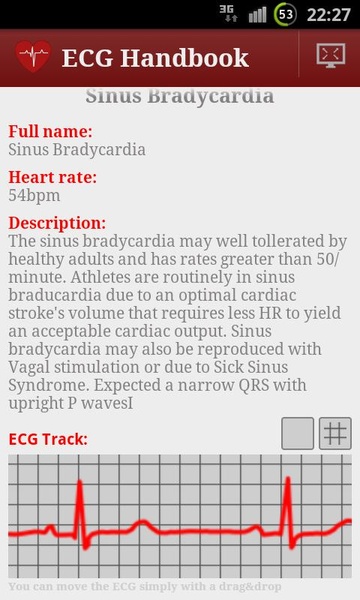ECG Handbook Trial - Preview 4