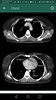 Ruky_CT Scan Anatomy screenshot 4