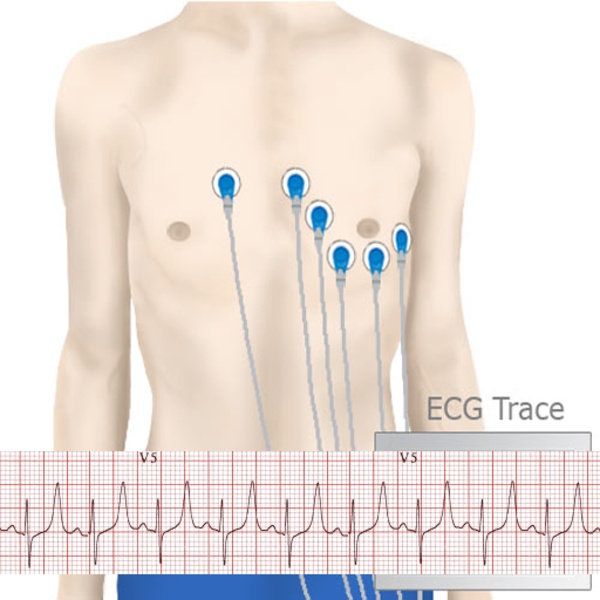 Basic ECG Interpretation - Preview 8