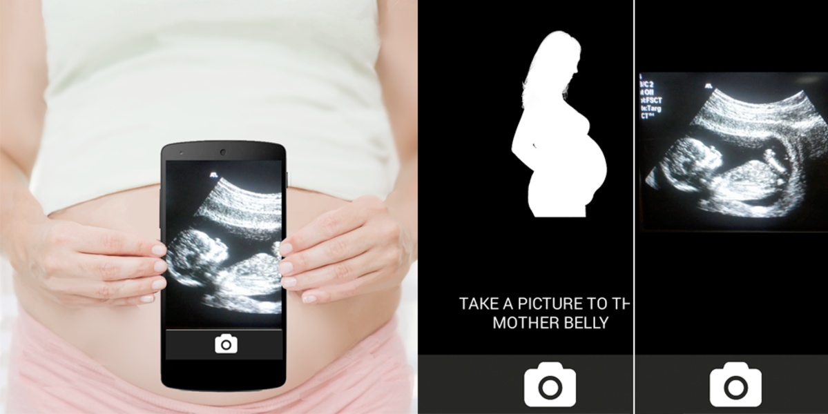 Pregnancy Test Scan Simulator - Preview 2