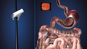 Endoscopy 3D (Free) screenshot 4