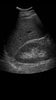 Ultrasound Scanner screenshot 1
