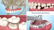 Dental 3D Illustrations screenshot 11