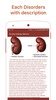 Kidney Diseases & Treatment screenshot 2