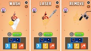 Tattoo Removal 3D Games screenshot 5