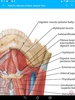 Anatomy Atlas, USMLE, Clinical screenshot 5