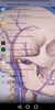 Imaging Brain, Skull & Craniocervical Vasculature screenshot 5