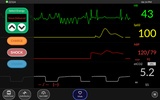 Simpl - Simulated Patient Monitor screenshot 3