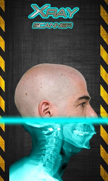 Xray Scanner Prank - Preview 1